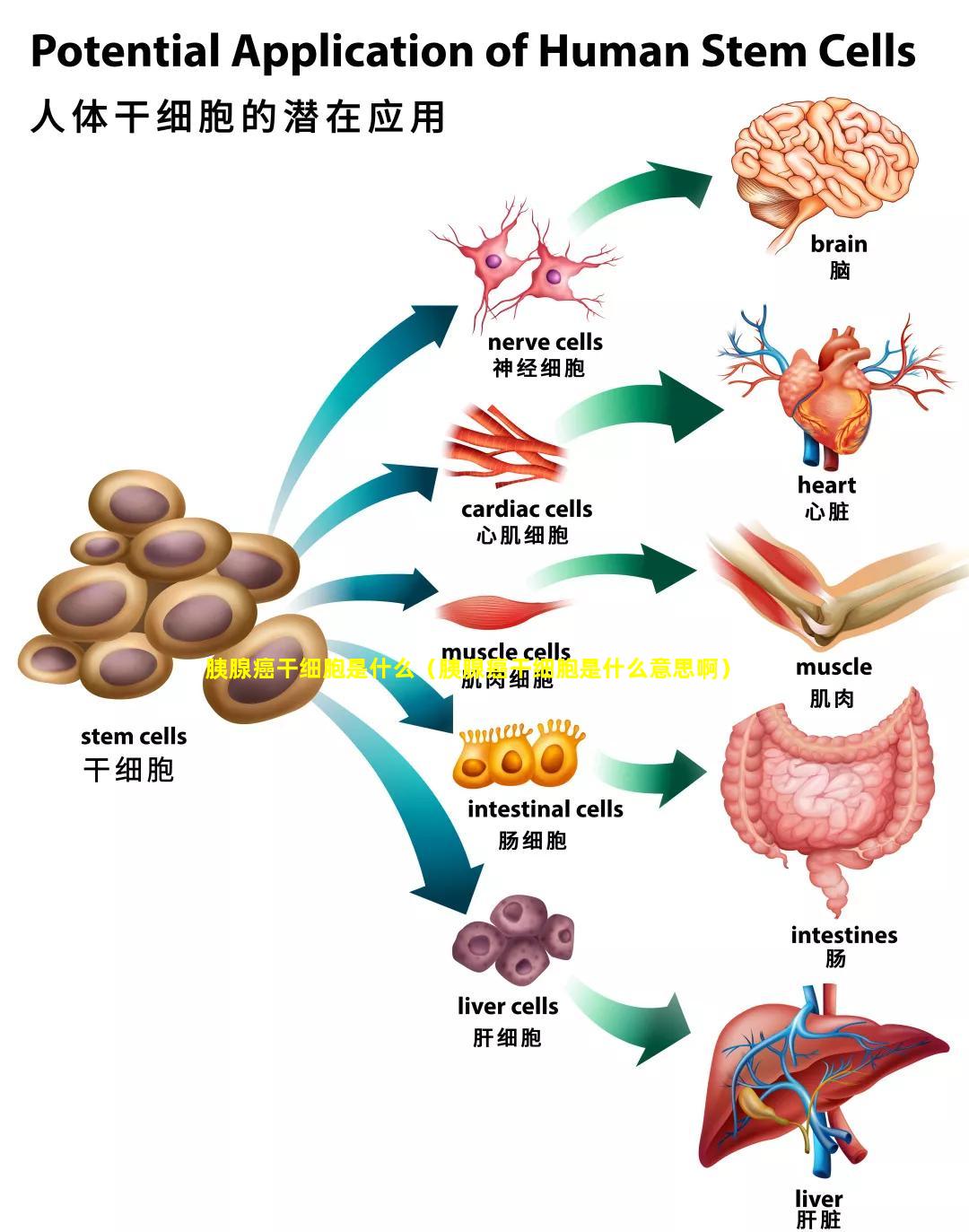 胰腺癌干细胞是什么（胰腺癌干细胞是什么意思啊）
